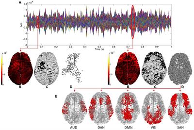 Fractal dimension analysis of resting state functional networks in schizophrenia from EEG signals